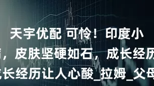 天宇优配 可怜！印度小孩身患怪病，皮肤坚硬如石，成长经历让人心酸_拉姆_父母_孩子